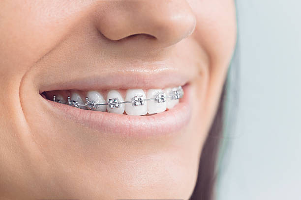 Best Dental Fillings (Composite and Amalgam)  in Fortville, IN